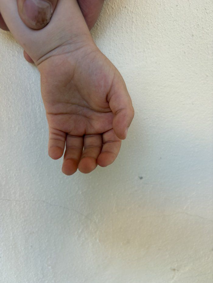 Foto principale della manina